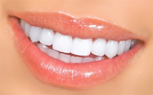 Trồng răng sứ cố định có tốt không? Tìm hiểu-3 Trồng răng sứ cố định có tốt không? Tìm hiểu-3