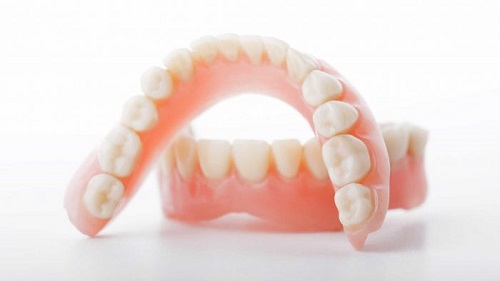 Trồng răng giả có lâu không? Phụ thuộc vào yếu tố nào? 2