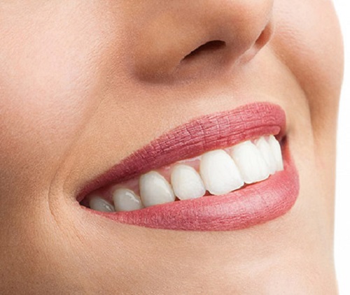 Trồng răng sứ dùng được bao lâu? Tùy thuộc yếu tố nào? 3