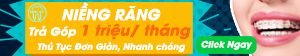 niềng răng trả góp