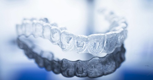 Niềng răng invisalign có nhổ răng không? Tìm hiểu tại nha khoa 1