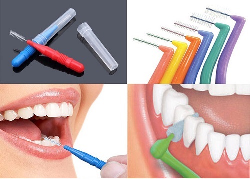 Niềng răng dùng bàn chải gì dễ dàng vệ sinh? 3