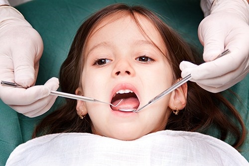 Niềng răng cho trẻ em ở đâu tphcm tốt nhất? 1