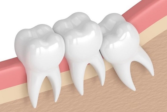 Nhổ răng khôn phải xét nghiệm máu không bác sĩ? 2