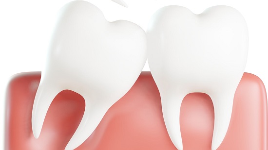 Nhổ răng khôn phải xét nghiệm máu không bác sĩ? 3